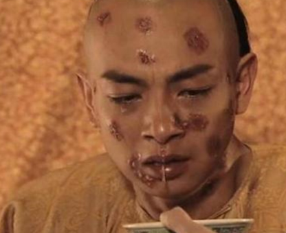 古代天花是怎么出现的 这种病为什么现在看不到了