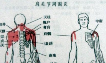 在现代医学中，冻结肩与肩周炎究竟有怎样的区别？