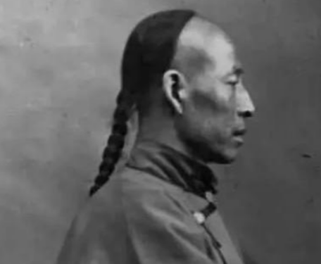 清朝规定男性都要留辫子，那秃顶和光头的人怎么办？