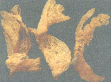 张石顽著有哪些医学理论？对后世医学都有着什么影响