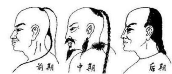 清朝男子一律要留辫子，那光头的和尚怎么办？