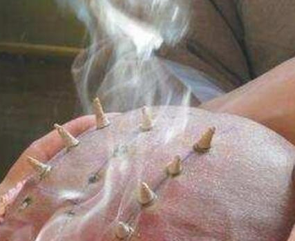 古代和尚为何要在头上烧戒疤 其实里面是有故事的