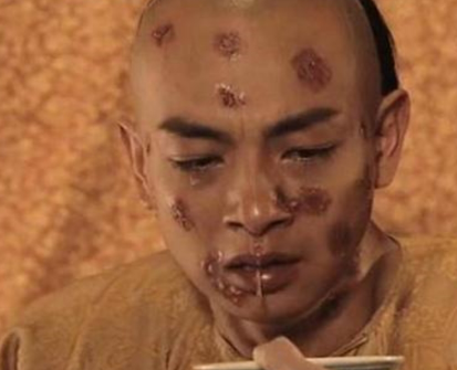 古代天花到底是什么病 为何古人如此的害怕天花