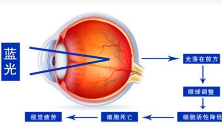 在现代社会蓝光对人眼的危害，主要表现在哪些方面？