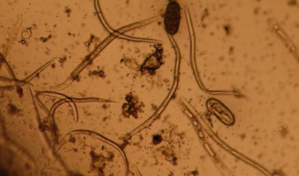 在自然界的生物中，目前关于恶魔线虫有怎样的研究？