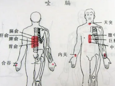 本草纲目·第三卷·百病主治·噎膈原文是什么内容？